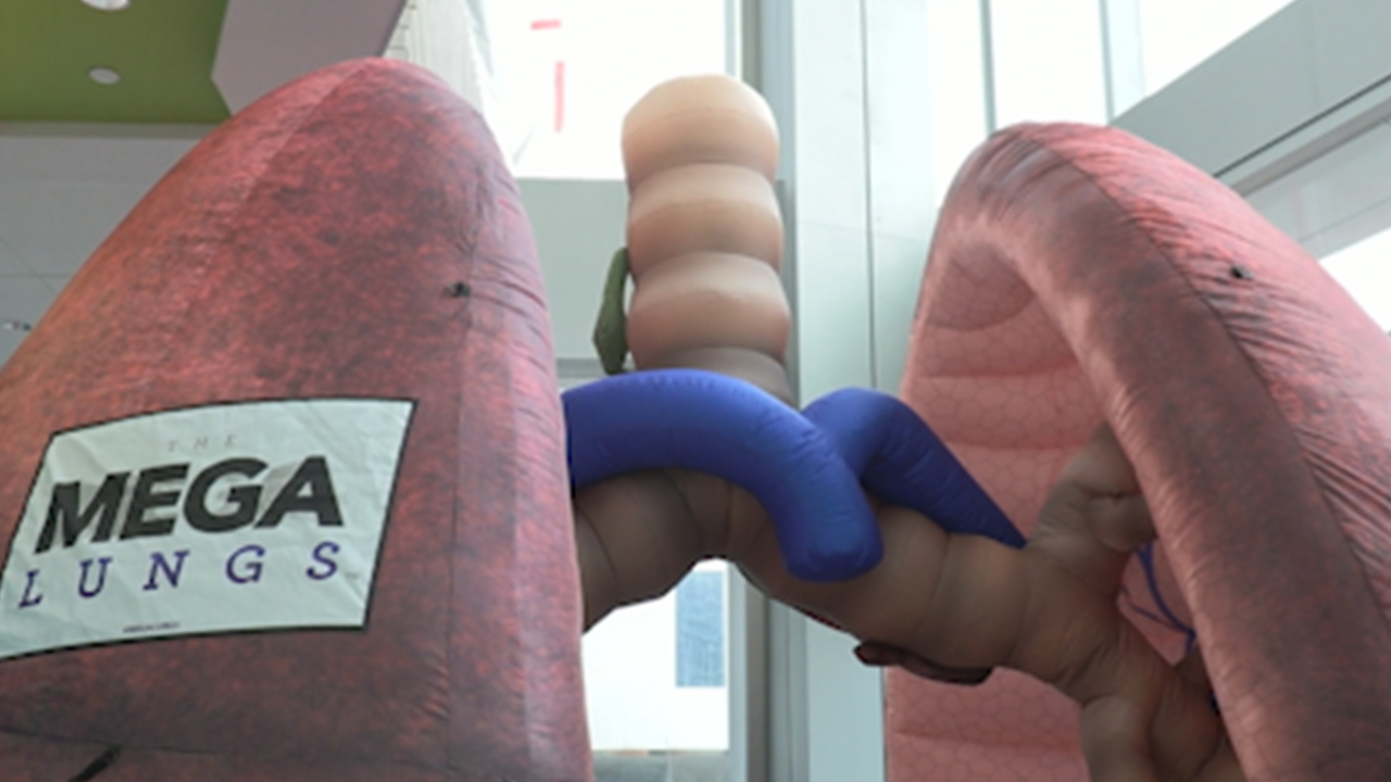 An inflatable lung propped in the lobby of the Upstate Medical Cancer Center in Syracuse, N.Y.